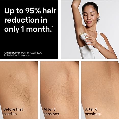 Braun IPL, Seda·Expert Pro 5